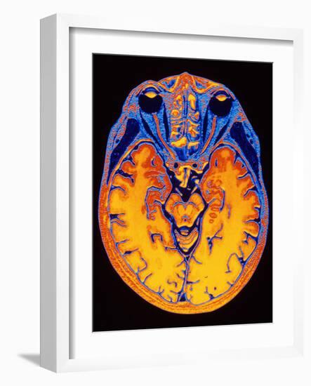 MRI Brain Scan-PASIEKA-Framed Photographic Print