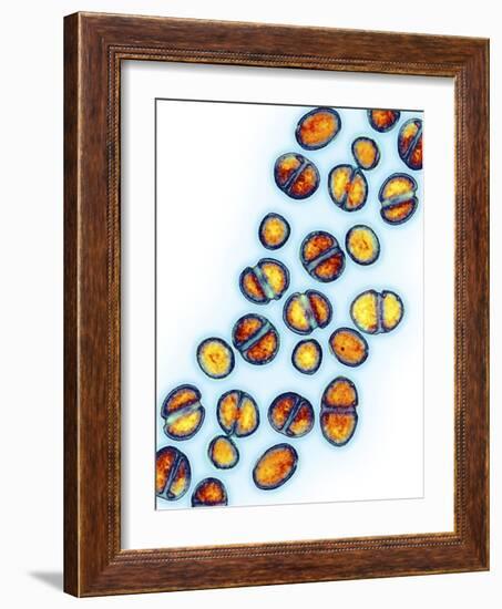 MRSA Bacteria, TEM-Biomedical Imaging-Framed Photographic Print