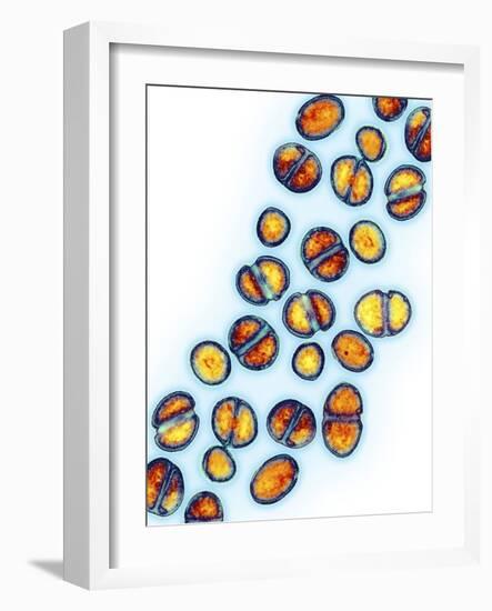 MRSA Bacteria, TEM-Biomedical Imaging-Framed Photographic Print