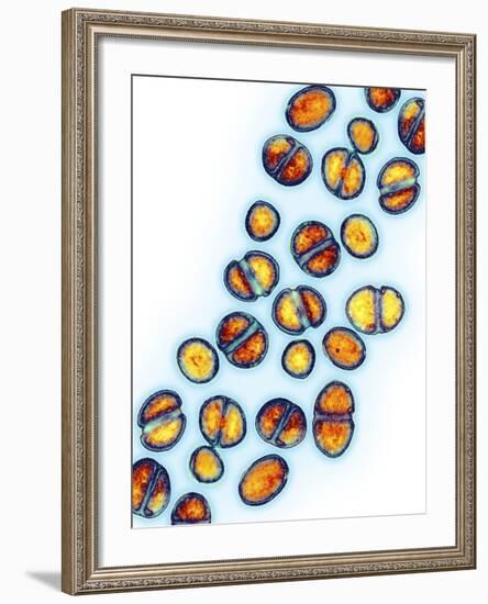 MRSA Bacteria, TEM-Biomedical Imaging-Framed Photographic Print