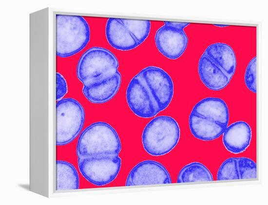 MRSA Bacteria-Biomedical Imaging-Framed Premier Image Canvas