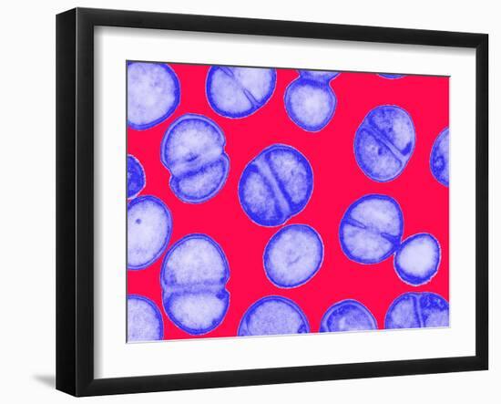 MRSA Bacteria-Biomedical Imaging-Framed Photographic Print