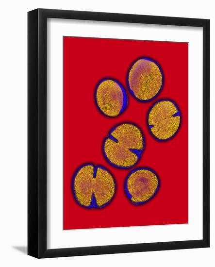 MRSA Bacteria-Biomedical Imaging-Framed Photographic Print