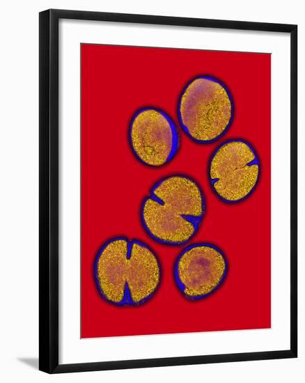 MRSA Bacteria-Biomedical Imaging-Framed Photographic Print