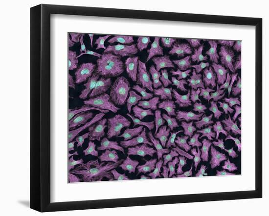 Multiphoton Fluorescence Image of Hela Cells-Stocktrek Images-Framed Photographic Print