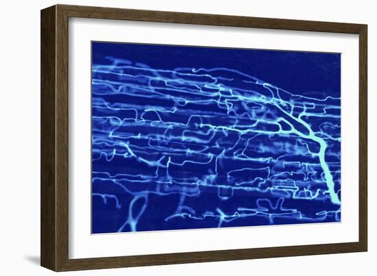 Muscle Blood Supply, Light Micrograph-Steve Gschmeissner-Framed Photographic Print