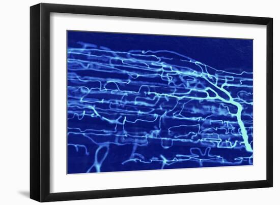 Muscle Blood Supply, Light Micrograph-Steve Gschmeissner-Framed Photographic Print