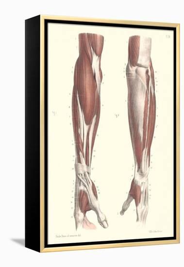 Musculature of the Forearm-null-Framed Stretched Canvas