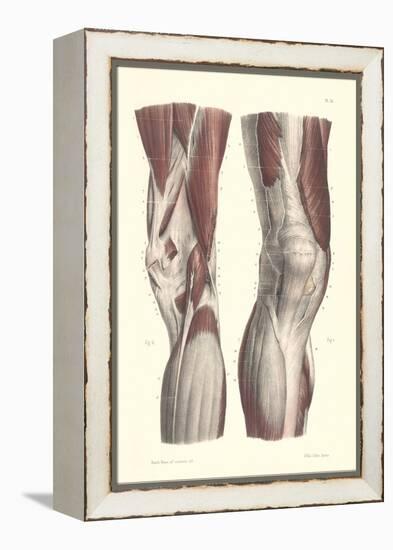 Musculature of the Knee Area-null-Framed Stretched Canvas