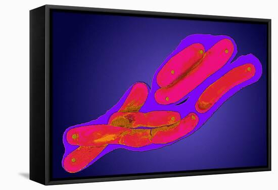 Mycobacterium Tuberculosis Bacteria-Dr. Linda Stannard-Framed Premier Image Canvas