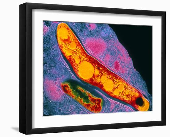 Mycobacterium Tuberculosis Bacterium-null-Framed Photographic Print