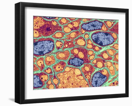 Myelination of Nerve Fibres, TEM-Thomas Deerinck-Framed Photographic Print