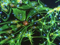 Immunofluorescent LM of Astrocyte Brain Cells-Nancy Kedersha-Framed Photographic Print