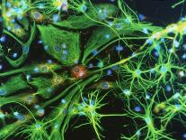 Immunofluorescent LM of Astrocyte Brain Cells-Nancy Kedersha-Mounted Photographic Print