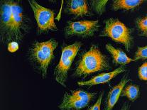 Immunofluorescent LM of Macrophage In Brain Tissue-Nancy Kedersha-Framed Premier Image Canvas