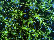 Immunofluorescent LM of Neurons & Astrocytes-Nancy Kedersha-Framed Photographic Print