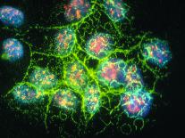 Immunofluorescent LM of Macrophage In Brain Tissue-Nancy Kedersha-Photographic Print