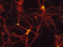 Immunofluorescent LM of Astrocyte Brain Cells-Nancy Kedersha-Mounted Photographic Print