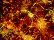 Nerve Cells-Nancy Kedersha-Photographic Print