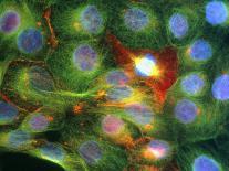 Immunofluorescent LM of Astrocyte Brain Cells-Nancy Kedersha-Framed Premier Image Canvas