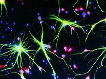 Immunofluorescent LM of Astrocyte Brain Cells-Nancy Kedersha-Mounted Photographic Print