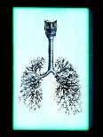 Human Lungs-Neal Grundy-Photographic Print