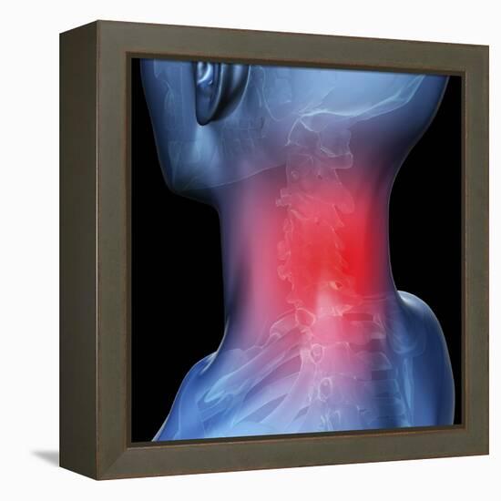 Neck Pain, Conceptual Artwork-David Mack-Framed Premier Image Canvas