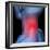 Neck Pain, Conceptual Artwork-David Mack-Framed Premium Photographic Print