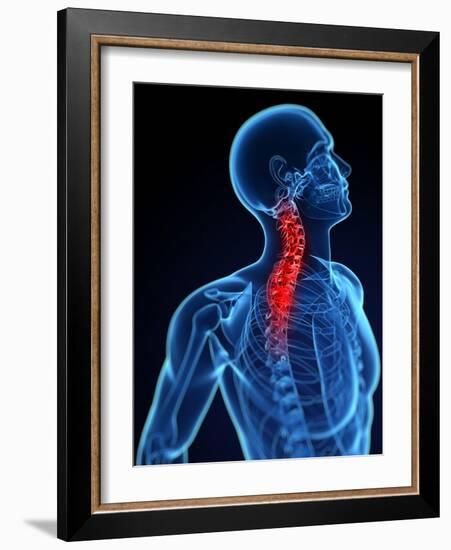 Neck Pain, Conceptual Artwork-SCIEPRO-Framed Photographic Print