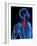 Neck Pain, Conceptual Artwork-SCIEPRO-Framed Photographic Print