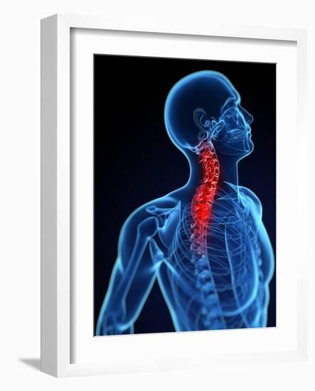 Neck Pain, Conceptual Artwork-SCIEPRO-Framed Photographic Print