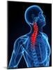 Neck Pain, Conceptual Artwork-SCIEPRO-Mounted Photographic Print