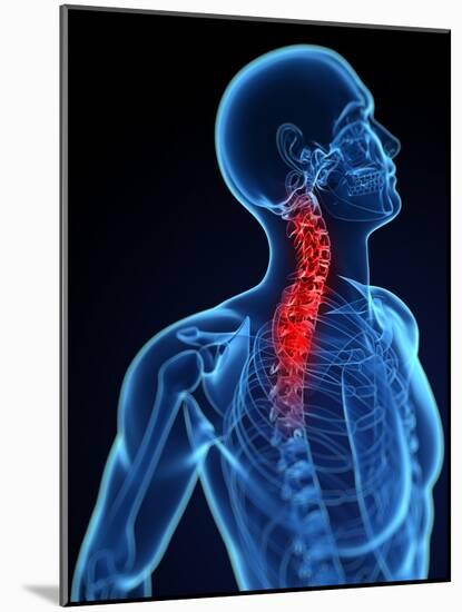 Neck Pain, Conceptual Artwork-SCIEPRO-Mounted Photographic Print