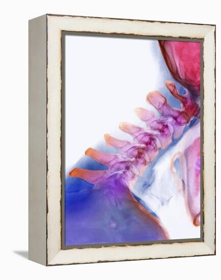 Neck Vertebrae Extended, X-ray-Science Photo Library-Framed Premier Image Canvas