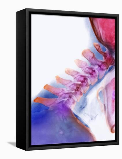Neck Vertebrae Extended, X-ray-Science Photo Library-Framed Premier Image Canvas