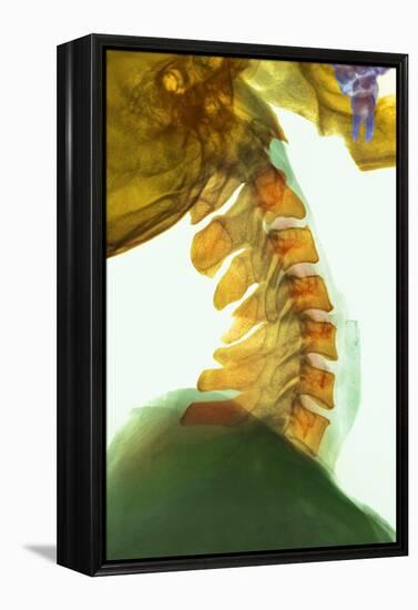 Neck Vertebrae Flexed, X-ray-Science Photo Library-Framed Premier Image Canvas