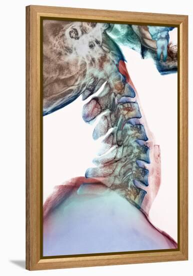 Neck Vertebrae Flexed, X-ray-Science Photo Library-Framed Premier Image Canvas