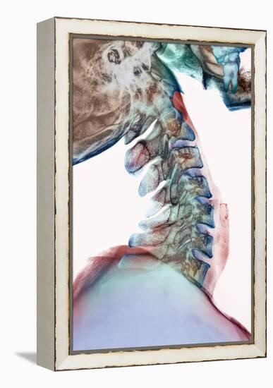 Neck Vertebrae Flexed, X-ray-Science Photo Library-Framed Premier Image Canvas