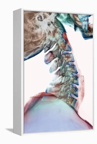 Neck Vertebrae Flexed, X-ray-Science Photo Library-Framed Premier Image Canvas