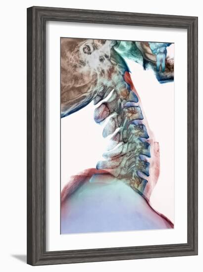 Neck Vertebrae Flexed, X-ray-Science Photo Library-Framed Photographic Print