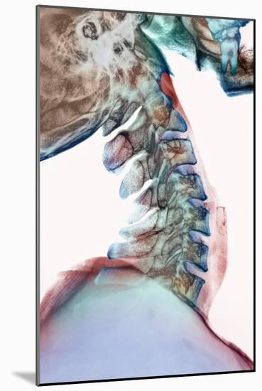 Neck Vertebrae Flexed, X-ray-Science Photo Library-Mounted Photographic Print