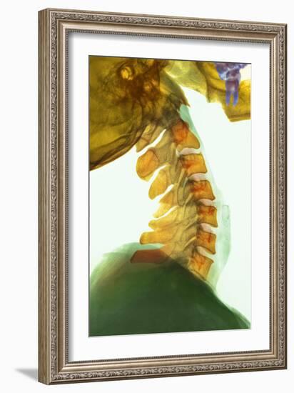 Neck Vertebrae Flexed, X-ray-Science Photo Library-Framed Photographic Print