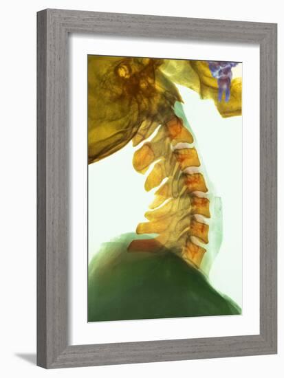 Neck Vertebrae Flexed, X-ray-Science Photo Library-Framed Photographic Print