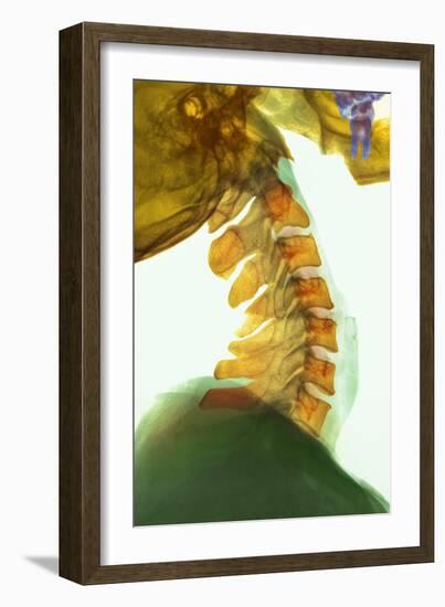 Neck Vertebrae Flexed, X-ray-Science Photo Library-Framed Photographic Print