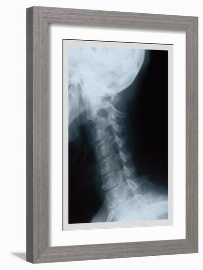 Neck-null-Framed Art Print