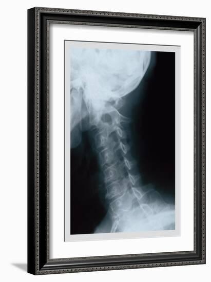 Neck-null-Framed Art Print