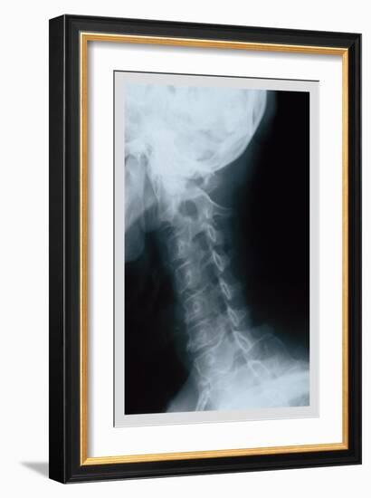 Neck-null-Framed Art Print