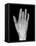 Needle Stuck In Hand, X-ray-Du Cane Medical-Framed Premier Image Canvas