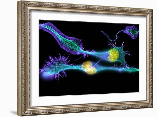 Nerve Cancer Cells, Light Micrograph-Dr. Torsten Wittmann-Framed Photographic Print