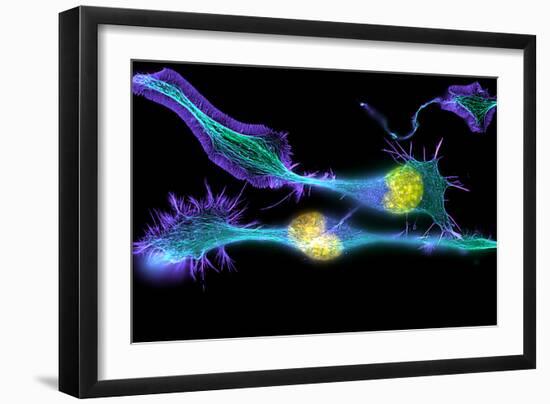 Nerve Cancer Cells, Light Micrograph-Dr. Torsten Wittmann-Framed Photographic Print